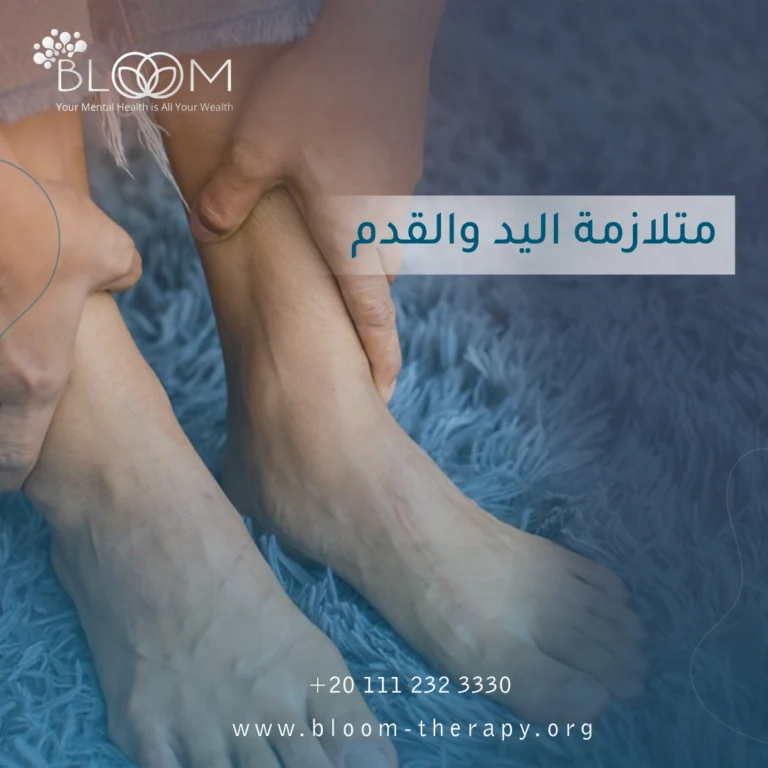 متلازمة اليد والقدم 