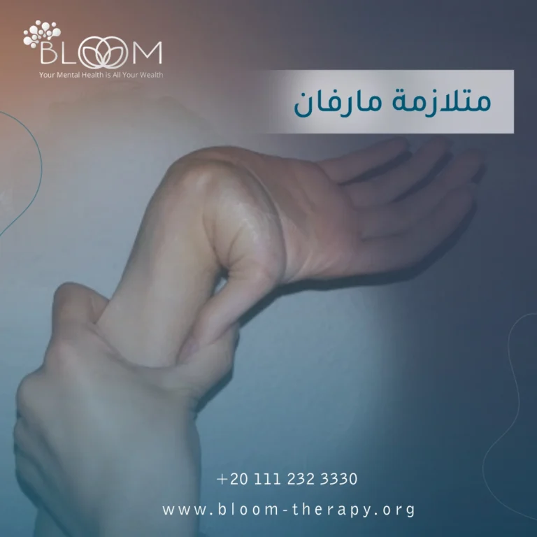 متلازمة مارفان